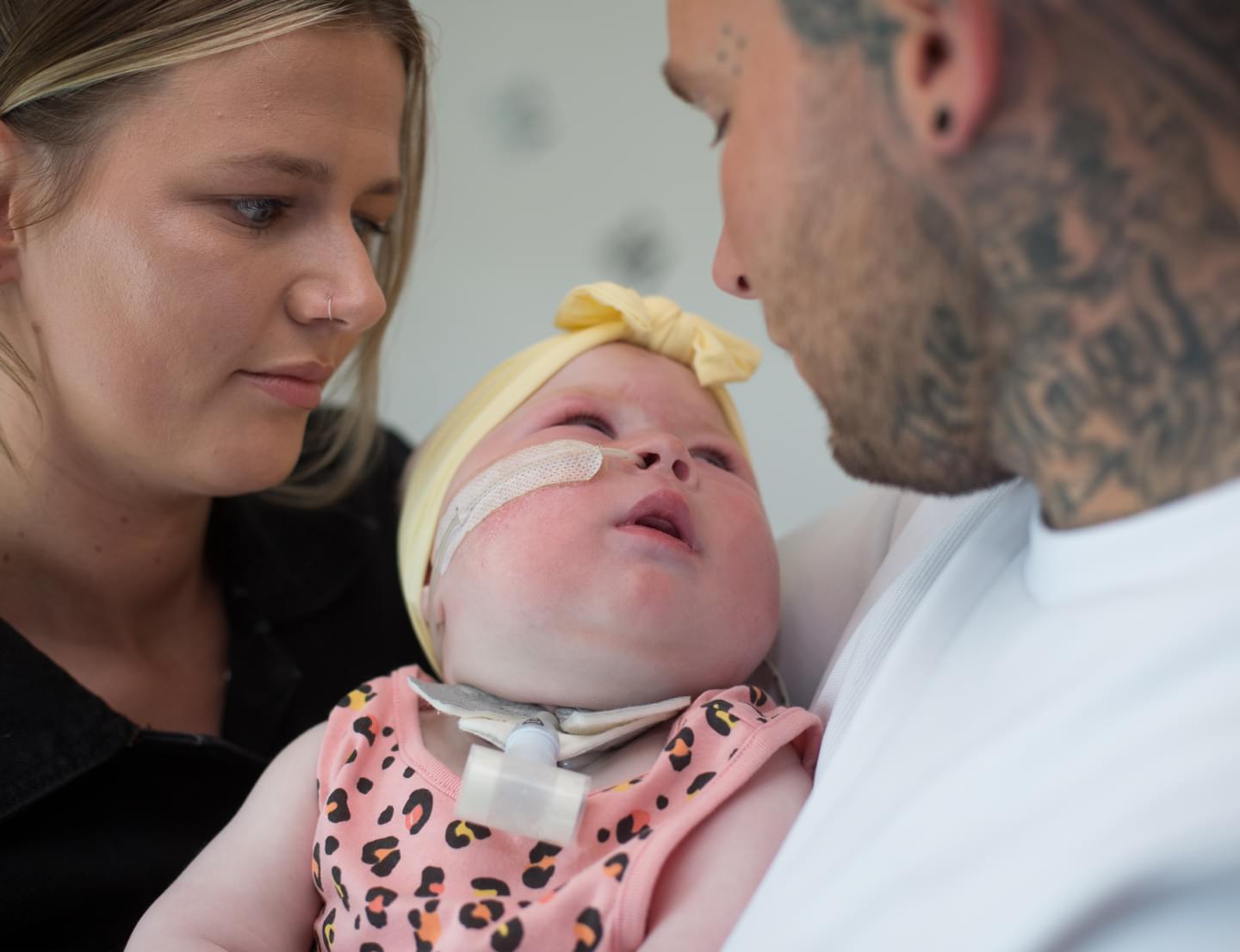 Mum and dad hold their baby daughter who has a tracheostomy.